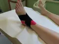 Caviglia fasciata con nastro kinesiologico nero e rosa per supporto.