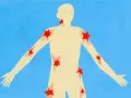 Silhouette umana con punti rossi a forma di stella che indicano aree di dolore, come un trigger point.