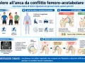 Il conflitto femoro-acetabolare causa dolore all'anca, specialmente in sportivi. Illustra le forme CAM e Pincer, diagnosi e conseguenze.