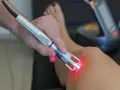 Trattamento con laser su ginocchio. La laserterapia è sicura, ma alcuni effetti collaterali lievi sono possibili.
