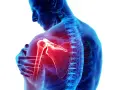 Dolore ai muscoli spalla evidenziato in rosso. Anatomia umana con focus sull'articolazione.
