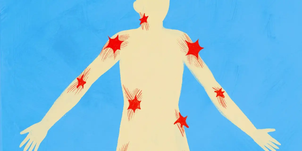 Silhouette umana con punti rossi a forma di stella che indicano aree di dolore, come un trigger point.