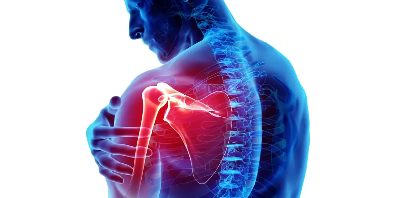 Dolore ai muscoli spalla evidenziato in rosso. Anatomia umana con focus sull'articolazione.