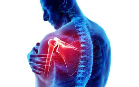 Dolore ai muscoli spalla evidenziato in rosso. Anatomia umana con focus sull'articolazione.