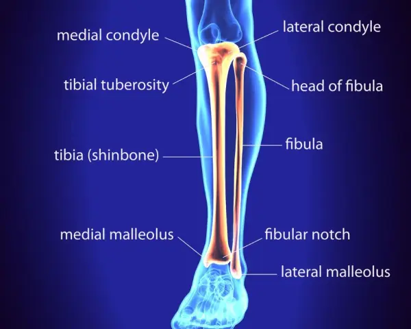 Anatomia delle ossa della gamba: tibia (stinbone) e fibula, con dettagli come condili e malleoli.