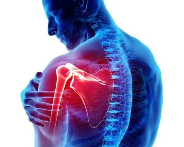 Dolore ai muscoli spalla evidenziato in rosso. Anatomia umana con focus sull'articolazione.