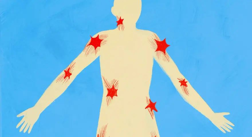 Silhouette umana con punti rossi a forma di stella che indicano aree di dolore, come un trigger point.