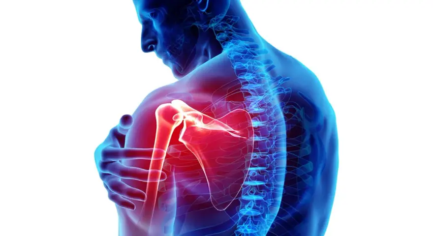 Dolore ai muscoli spalla evidenziato in rosso. Anatomia umana con focus sull'articolazione.