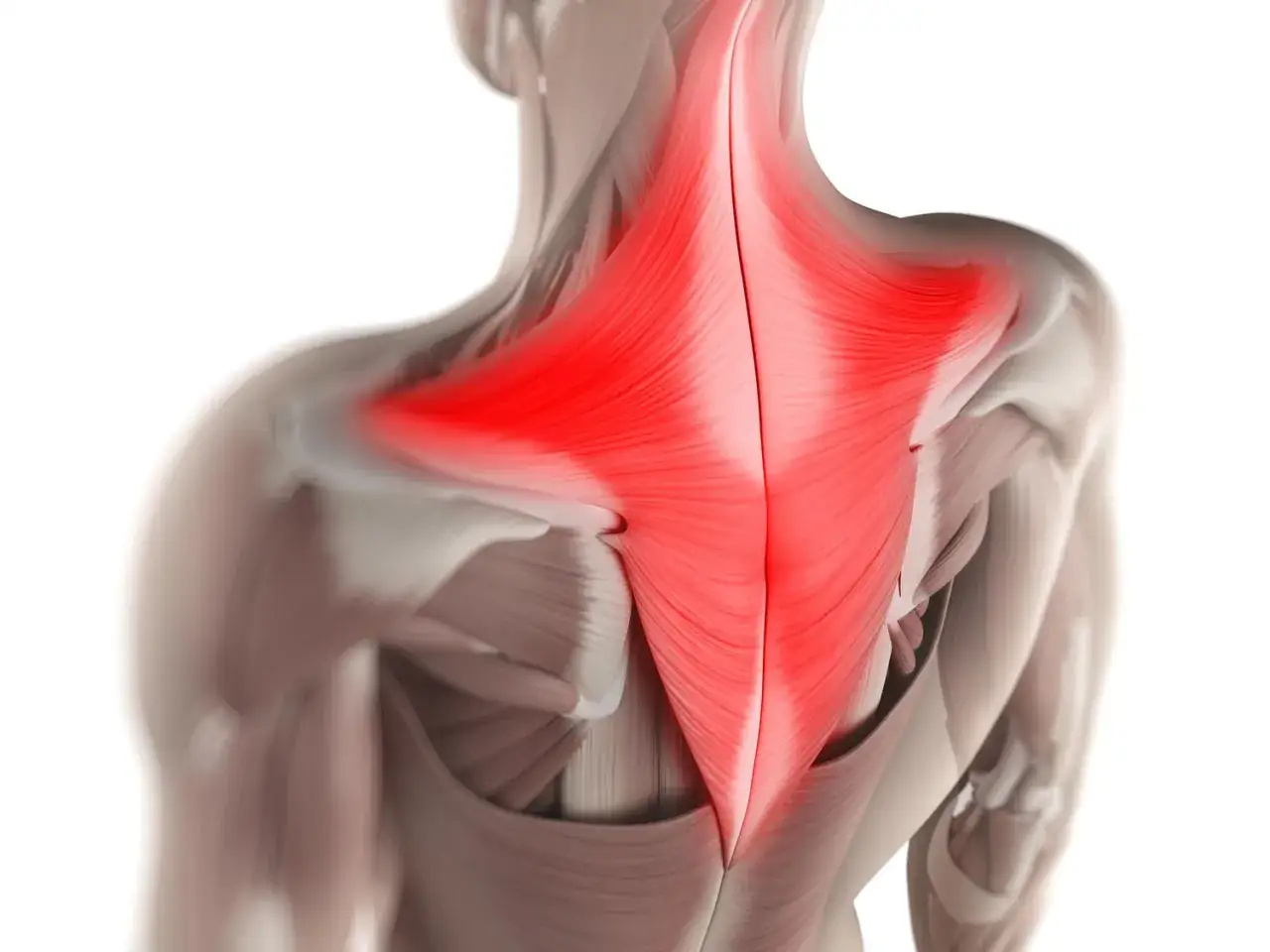 Dettaglio anatomico del muscolo trapezio, evidenziato in rosso per indicare dolore o infiammazione.
