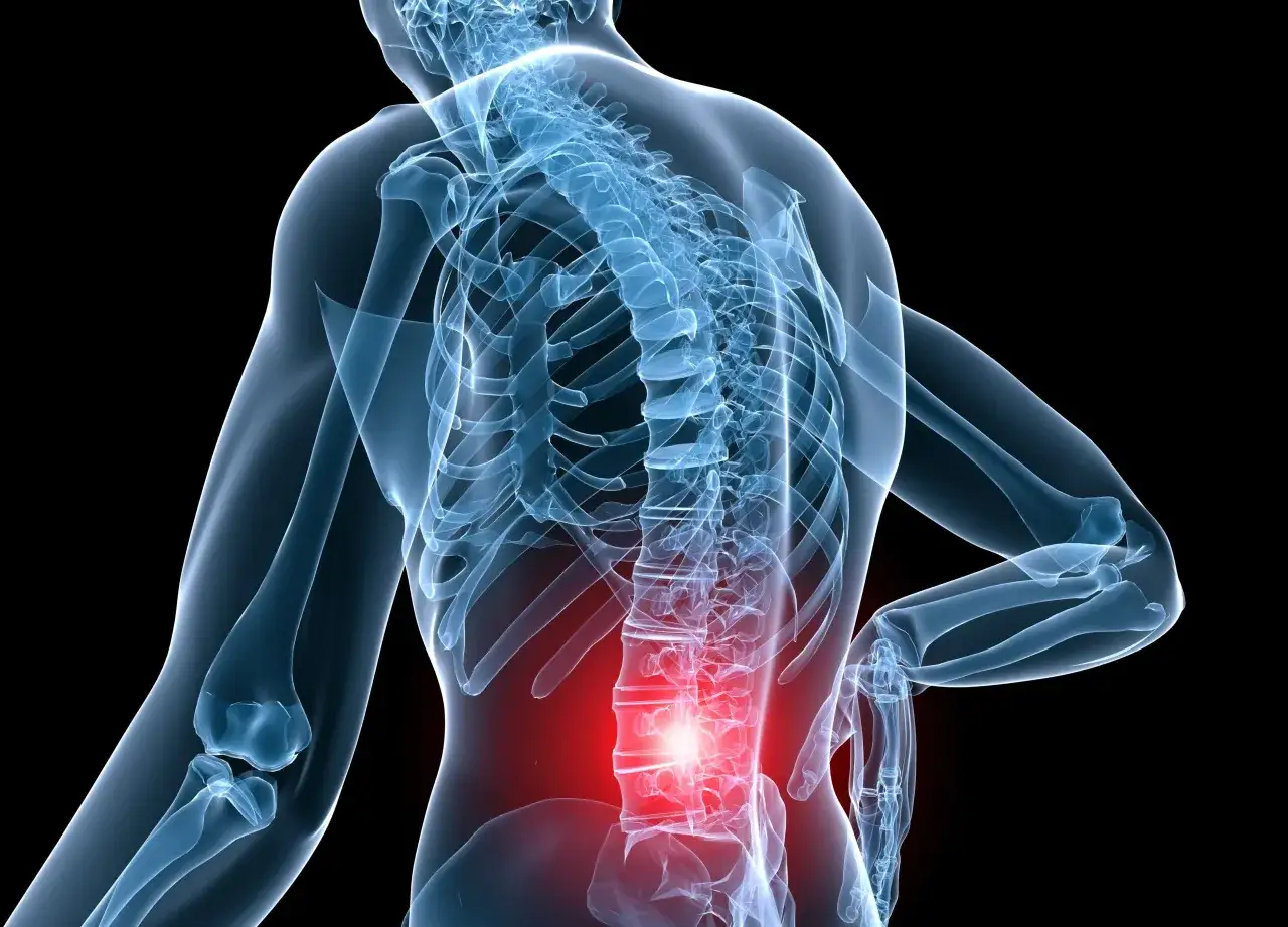 Rappresentazione anatomica di una schiena che scrocchia, con la zona lombare evidenziata in rosso per indicare dolore o infiammazione.