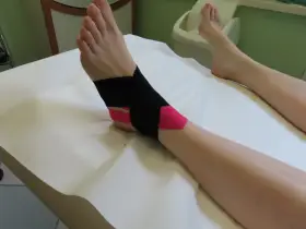 Caviglia fasciata con nastro kinesiologico nero e rosa per supporto.